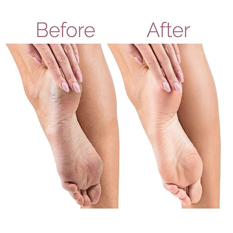 Electric Pedicure Foot File